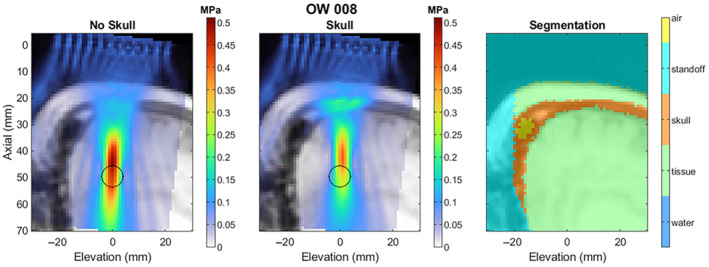 0eacd612-3a34-11f1-ab55-92fbcf53809c.png