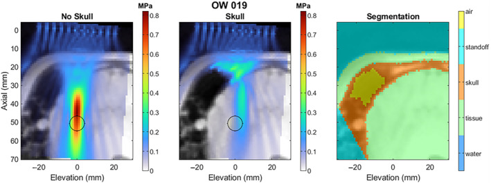0eb77d92-3a34-11f1-ab55-92fbcf53809c.png