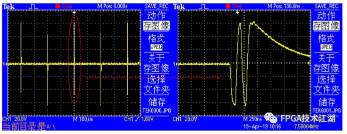 超声成像