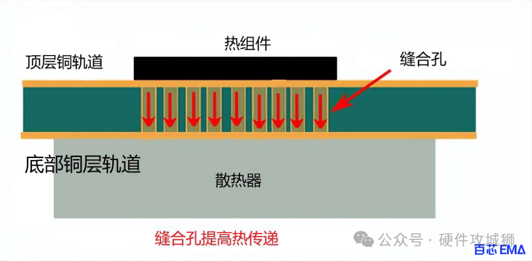 缝合孔