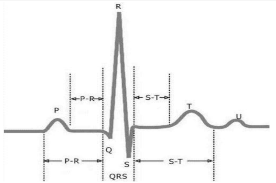 13-心电波形监测技术.png