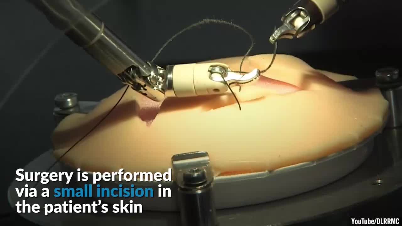 外科手術機器人將如何革新醫療系統