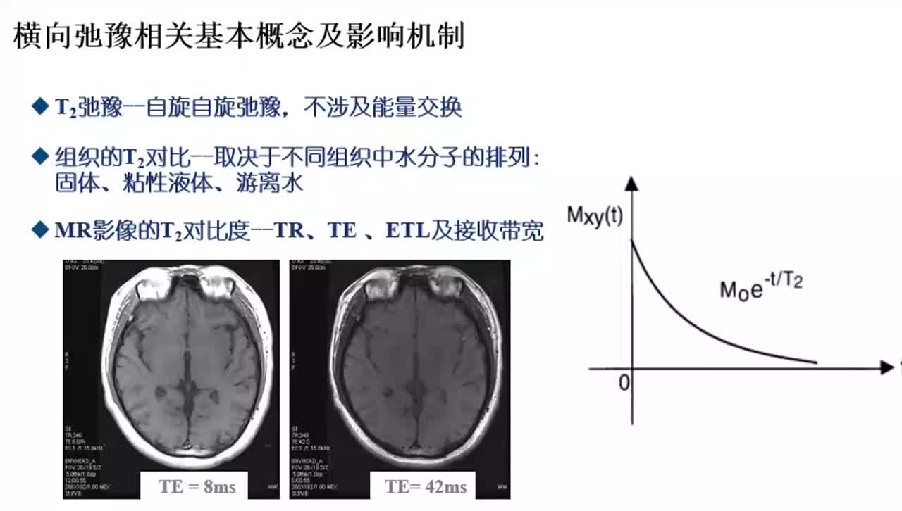 #硬声创作季 #磁共振 磁共振成像原理与威廉希尔官方网站
-015横向弛豫相关基本概念及影响机制