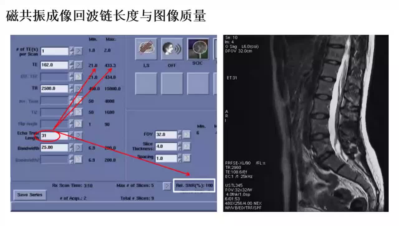 #硬声创作季 #磁共振 磁共振成像原理与威廉希尔官方网站
-026磁共振成像回波链长度与图像质量2