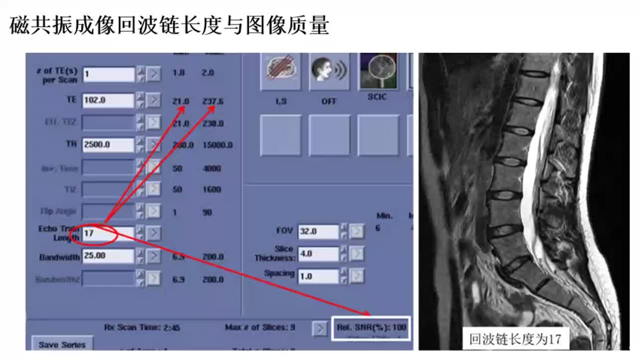 #硬声创作季 #磁共振 磁共振成像原理与威廉希尔官方网站
-025磁共振成像回波链长度与图像质量1