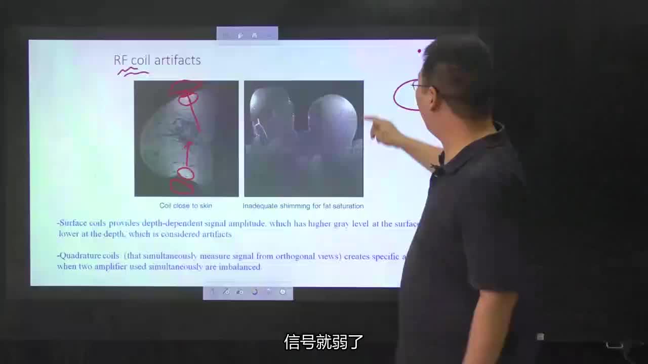 #硬声创作季 #医学成像 医学成像技术-065.MRI伪影-2