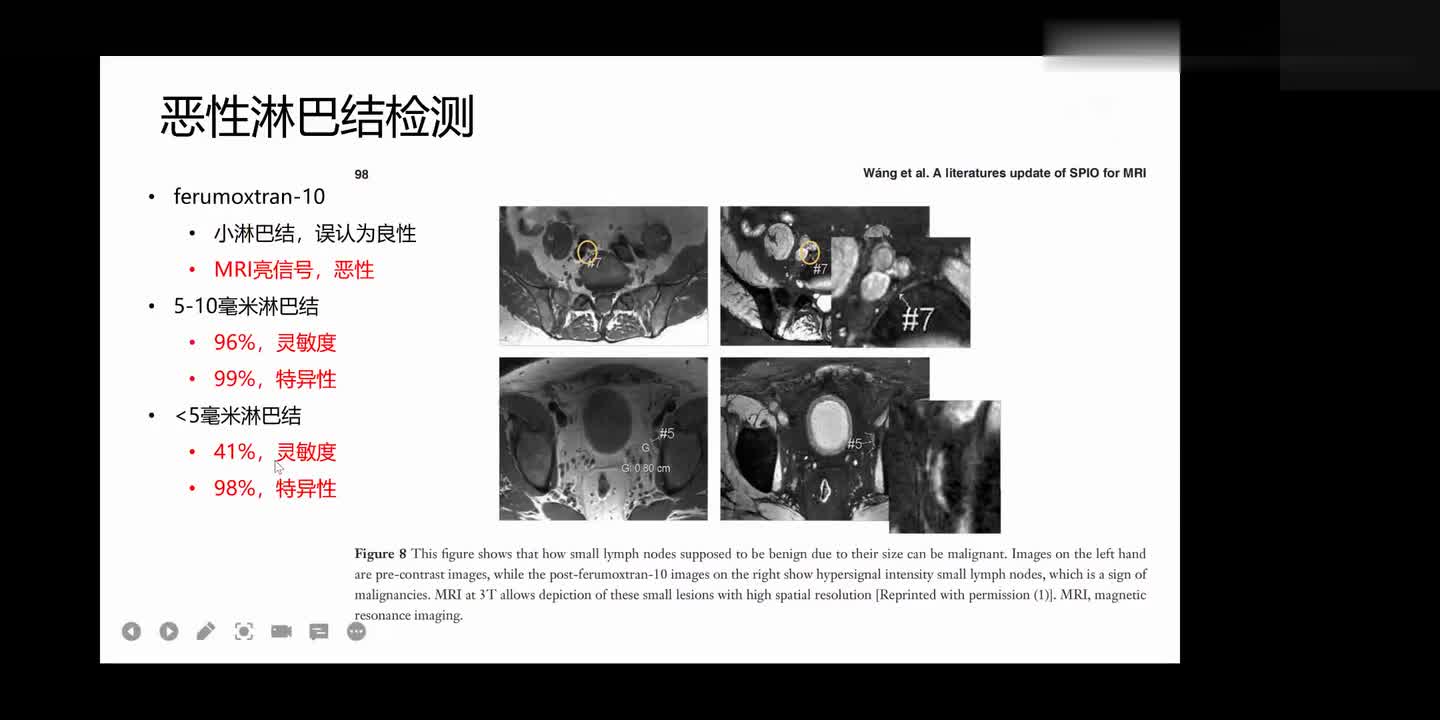 #硬聲創(chuàng)作季 #醫(yī)學(xué)成像 醫(yī)學(xué)成像技術(shù)-114.MPI-淋巴結(jié)轉(zhuǎn)移診斷與磁粒子成像MPI-3