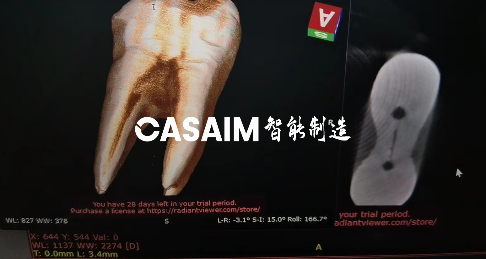 CASAIM与北京协和医院达成合作，通过CT重建...