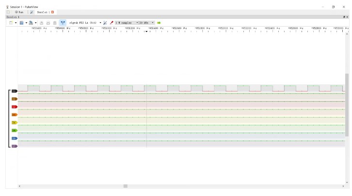 STM32单片机