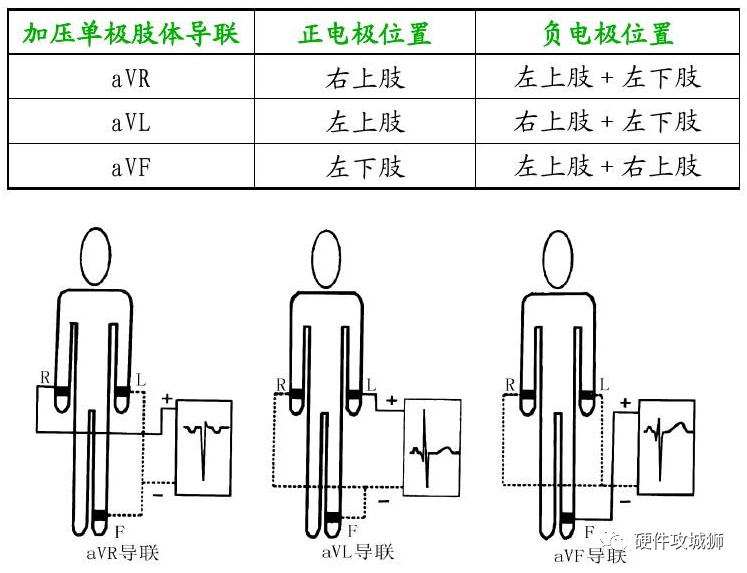 心电信号