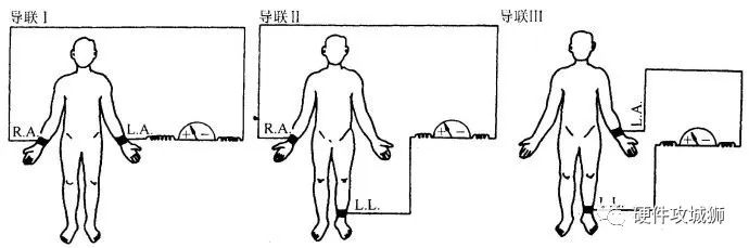 心电信号