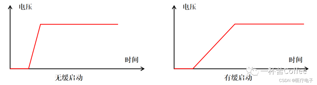 TVS管