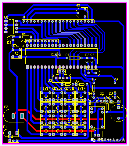 lcd