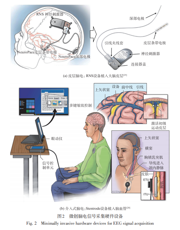 脑电信号