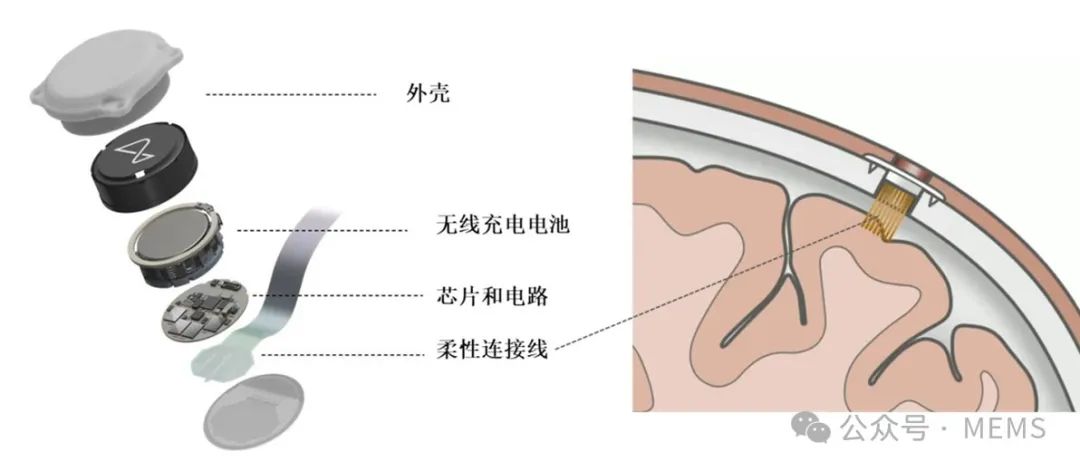 超声波