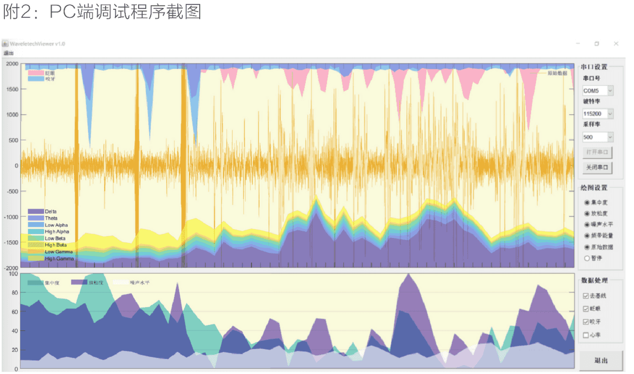 脑机接口