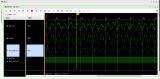基于FPGA LMS算法的<b class='flag-5'>自適應(yīng)</b>濾波器設(shè)計