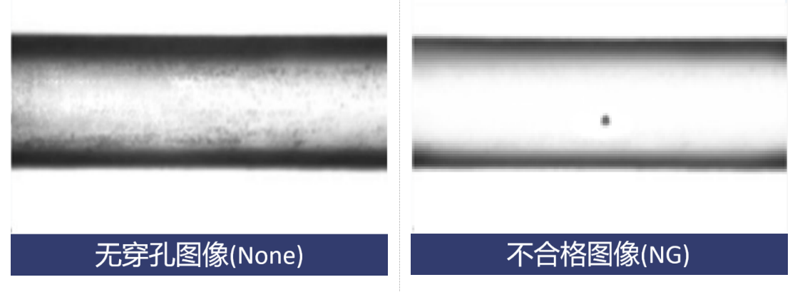 友思特案例 | 醫(yī)療設(shè)備行業(yè)<b class='flag-5'>視覺</b><b class='flag-5'>檢測</b>案例集錦（二）