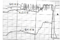 带磁致伸缩位移传感<b class='flag-5'>器</b><b class='flag-5'>调速器</b>停机分析及措施研究