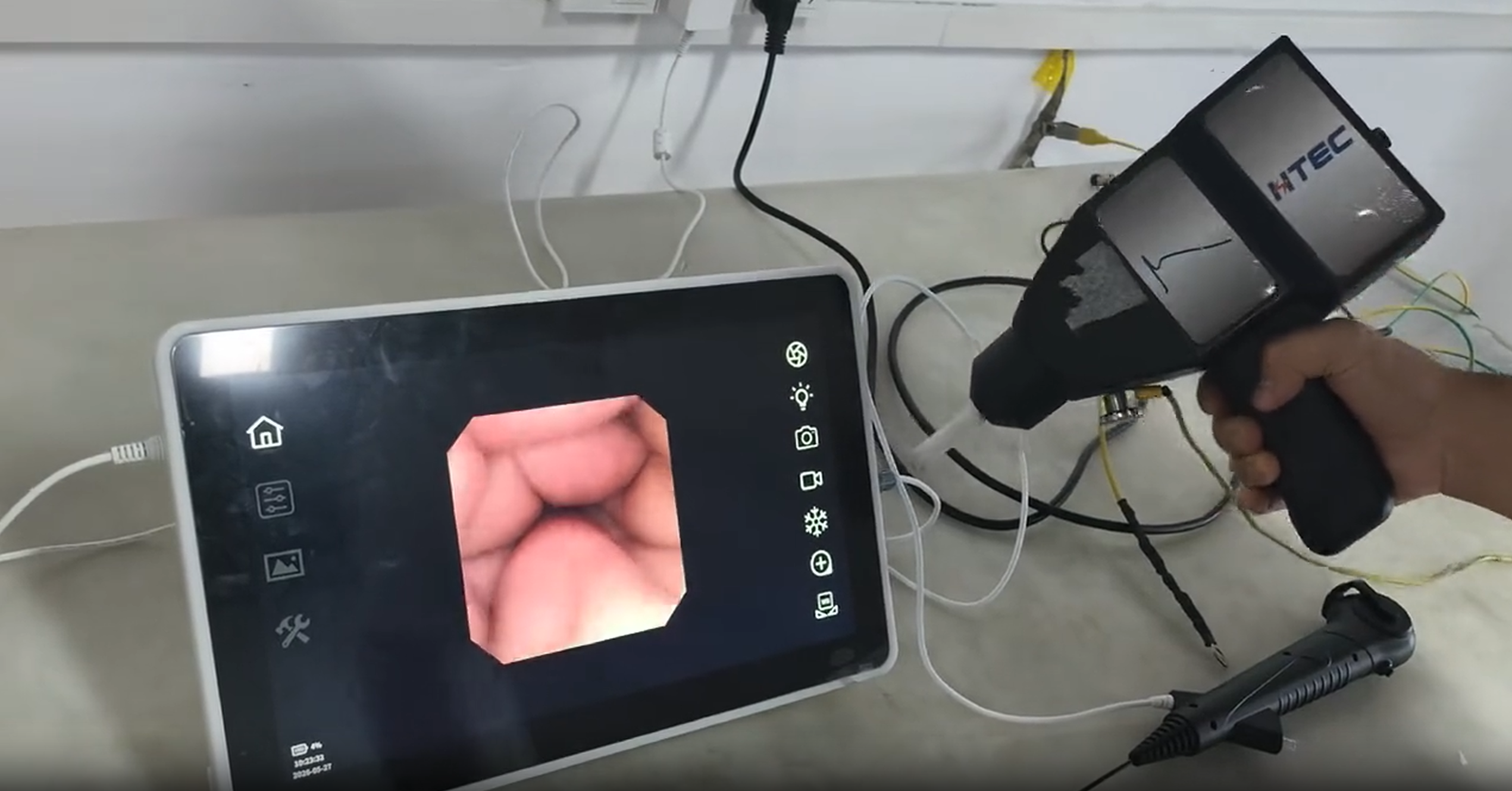便携医疗