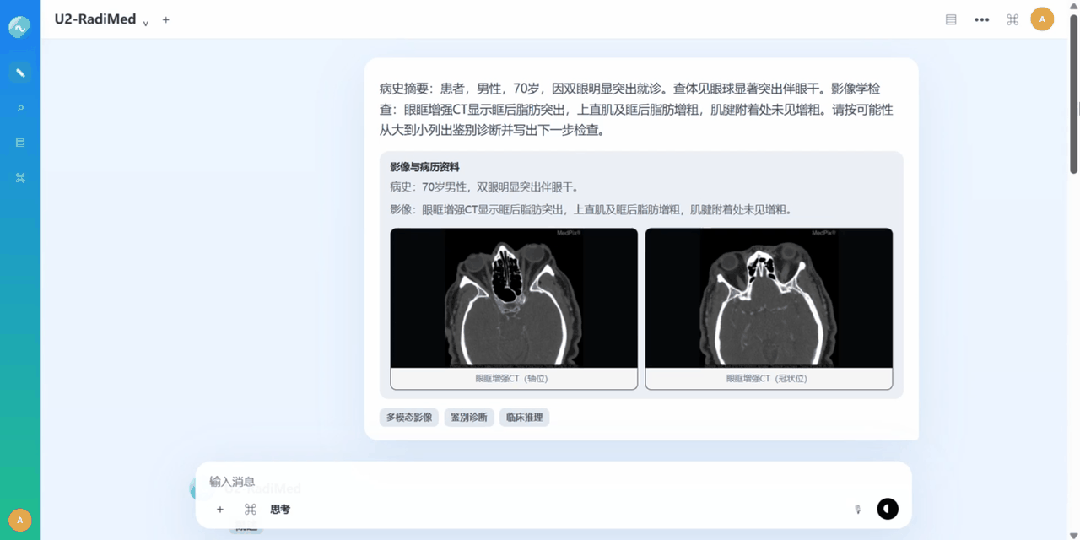 云知声自研医学影像多模态大模型U2-RadiMed正式发布